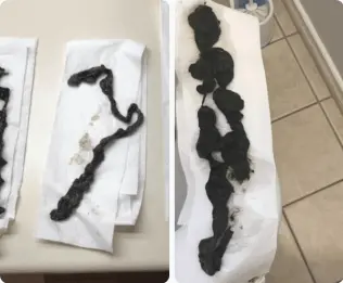 Para911 Parasites Cleanse Drops result